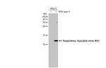 RSV NS1 Recombinant Rabbit Monoclonal Antibody (HL2383)