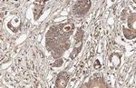 OASL Recombinant Rabbit Monoclonal Antibody (HL2399)