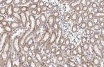 BCKDHA Recombinant Rabbit Monoclonal Antibody (HL2405)