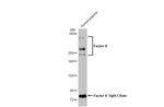 Factor V Recombinant Rabbit Monoclonal Antibody (HL2421)