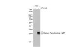 Human Parechovirus Type 1/3 VP1 Antibody in Western Blot (WB)