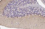 ADORA1 Antibody in Immunohistochemistry (Paraffin) (IHC (P))