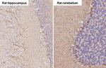 ADORA1 Antibody in Immunohistochemistry (Paraffin) (IHC (P))
