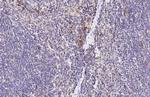 CCR4 Recombinant Rabbit Monoclonal Antibody (HL2481)