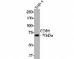 CD64 Antibody in Western Blot (WB)