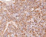 CD73 Antibody in Immunohistochemistry (Paraffin) (IHC (P))