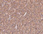 CD73 Antibody in Immunohistochemistry (Paraffin) (IHC (P))
