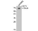 CD73 Antibody in Western Blot (WB)