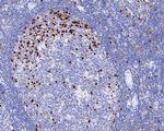 MUM1 Monoclonal Antibody (A7D1)