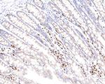 MUM1 Antibody in Immunohistochemistry (Paraffin) (IHC (P))