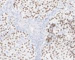 SALL4 Antibody in Immunohistochemistry (Paraffin) (IHC (P))