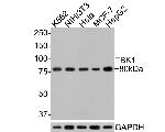 TBK1 Monoclonal Antibody (A8D9)