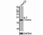 IL-7 Monoclonal Antibody (A8B11)