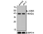 IL10RB Monoclonal Antibody (A8E11)