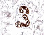 Mammaglobin A Antibody in Immunohistochemistry (Paraffin) (IHC (P))
