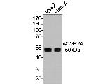 ACVR2A Monoclonal Antibody (A7C8)