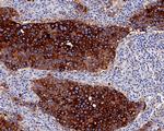 NAPSA Antibody in Immunohistochemistry (Paraffin) (IHC (P))