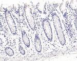 NAPSA Antibody in Immunohistochemistry (Paraffin) (IHC (P))