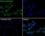BrdU Antibody in Immunocytochemistry (ICC/IF)