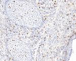 BrdU Antibody in Immunohistochemistry (Paraffin) (IHC (P))