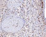 BrdU Antibody in Immunohistochemistry (Paraffin) (IHC (P))