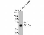 Human IgA Monoclonal Antibody (3-F5)