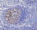 Ki-67 Antibody in Immunohistochemistry (Paraffin) (IHC (P))
