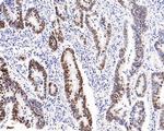 Ki-67 Antibody in Immunohistochemistry (Paraffin) (IHC (P))