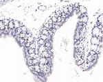 Ki-67 Antibody in Immunohistochemistry (Paraffin) (IHC (P))