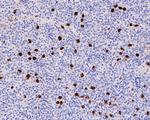 Thyroid Stimulating Hormone Antibody in Immunohistochemistry (Paraffin) (IHC (P))