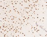MSH2 Antibody in Immunohistochemistry (Paraffin) (IHC (P))