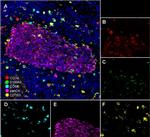 CD68 Antibody in Multiplex Immunohistochemistry (mIHC)