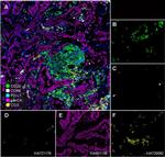 CD68 Antibody in Multiplex Immunohistochemistry (mIHC)