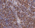 CD74 Antibody in Immunohistochemistry (Paraffin) (IHC (P))