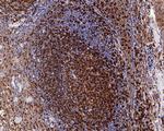 CD74 Antibody in Immunohistochemistry (Paraffin) (IHC (P))
