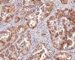 c-Met Antibody in Immunohistochemistry (Paraffin) (IHC (P))