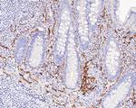 CD56 Antibody in Immunohistochemistry (Paraffin) (IHC (P))