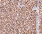 CD56 Antibody in Immunohistochemistry (Paraffin) (IHC (P))