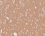 CD56 Antibody in Immunohistochemistry (Paraffin) (IHC (P))