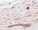 CD56 Antibody in Immunohistochemistry (Paraffin) (IHC (P))