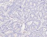 CD56 Antibody in Immunohistochemistry (Paraffin) (IHC (P))