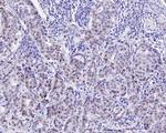GATA3 Antibody in Immunohistochemistry (Paraffin) (IHC (P))