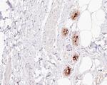 Mammaglobin A Antibody in Immunohistochemistry (Paraffin) (IHC (P))