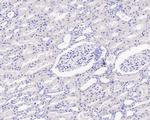 Mammaglobin A Recombinant Mouse Monoclonal Antibody (A9A2-R)