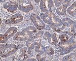Annexin VII Recombinant Rabbit Monoclonal Antibody (JE65-60)