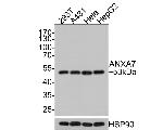 Annexin VII Antibody in Western Blot (WB)