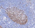 Ki-67 Antibody in Immunohistochemistry (Paraffin) (IHC (P))