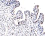 Ki-67 Antibody in Immunohistochemistry (Paraffin) (IHC (P))