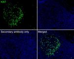 Ki-67 Antibody in Immunohistochemistry (Paraffin) (IHC (P))