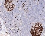 Ki-67 Antibody in Immunohistochemistry (Paraffin) (IHC (P))